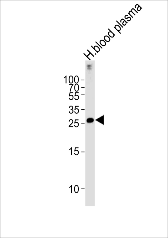 C1QB Antibody western blot of human blood plasma tissue lysates (35 ug/lane). The C1QB antibody detected the C1QB protein (arrow).