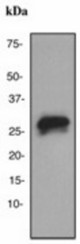 Western blot analysis on human plasma lysate using anti-C1q (subunit B) antibody (LS-C105459), dilution 1:1000.