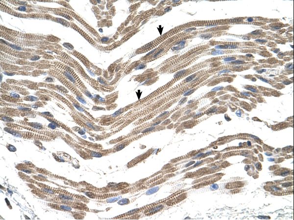 C1QB antibody LS-C80655 was used in IHC to stain formalin-fixed, paraffin-embedded human muscle.