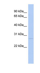 C1QB antibody LS-C110931 Western blot of Fetal Stomach lysate.