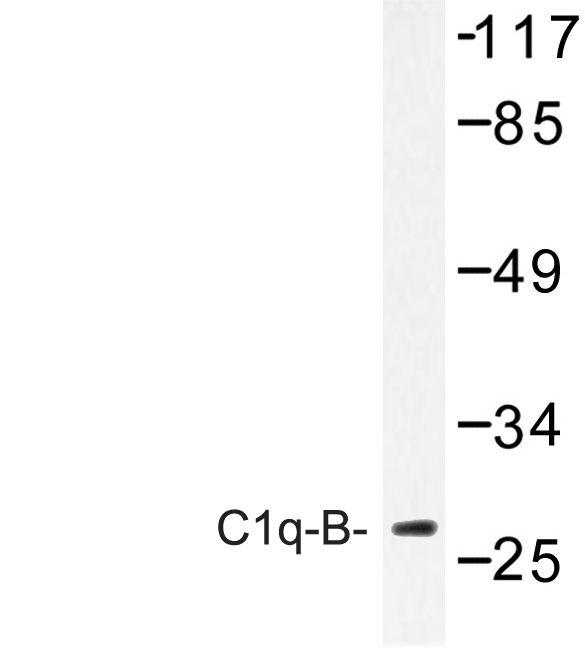 Western blot of C1q-B (V193) pAb in extracts from Jurkat cells.