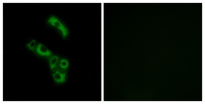 Immunofluorescence of A549 cells, using C1QB Antibody. The picture on the right is treated with the synthesized peptide.