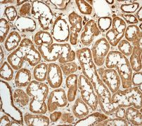 IHC of paraffin-embedded human kidney tissue using anti-C1q (subunit B) antibody (LS-C105671).