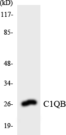 Western blot of the lysates from Jurkat cells using C1QB antibody.