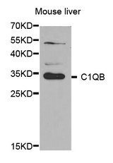 Western blot analysis of extracts of mouse liver, using C1QB antibody.