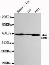 Western blot detection of CKMT1 in Mouse Colon,293&A431 cell lysates using CKMT1 antibody (1:1000 diluted).