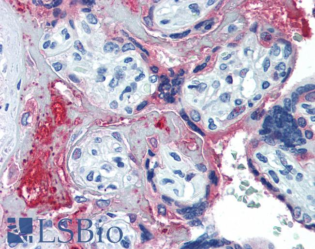 Anti-C6 / Complement C6 antibody IHC of human placenta. Immunohistochemistry of formalin-fixed, paraffin-embedded tissue after heat-induced antigen retrieval. Antibody LS-B3294 concentration 10 ug/ml.