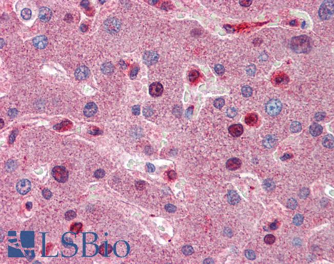 Anti-C8B antibody IHC of human liver. Immunohistochemistry of formalin-fixed, paraffin-embedded tissue after heat-induced antigen retrieval. Antibody LS-B5777 concentration 5 ug/ml.