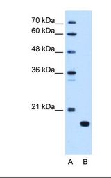 Lane A: Marker. Lane B: HepG2 cell lysate. Antibody concentration: 0.25 ug/ml. Gel concentration: 12%.