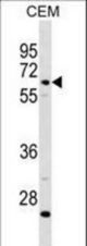 C8B Antibody western blot of CEM cell line lysates (35 ug/lane). The C8B antibody detected the C8B protein (arrow).