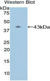 Western blot of recombinant Complement C8B.