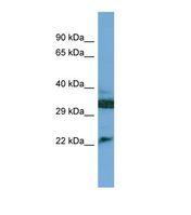 Western blot of Human Jurkat. C8G antibody dilution 1.0 ug/ml.