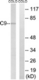 Western blot of extracts from COLO cells, using C9 Antibody. The lane on the right is treated with the synthesized peptide.