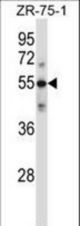 C9 Antibody western blot of ZR-75-1 cell line lysates (35 ug/lane). The C9 antibody detected the C9 protein (arrow).