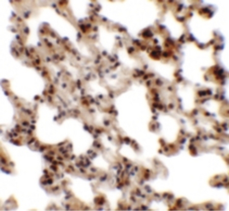 Immunohistochemistry of Coronin 7 in rat lung tissue with Coronin 7 antibody at 2.5 ug/ml.