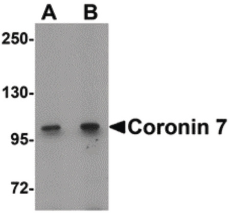Western blot of Coronin 7 in rat lung tissue lysate with Coronin 7 antibody at (A) 1 and (B) 2 ug/ml.