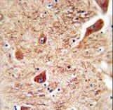 CORO7 antibody immunohistochemistry of formalin-fixed and paraffin-embedded human brain tissue followed by peroxidase-conjugated secondary antibody and DAB staining.