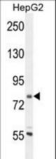 CORO7 Antibody western blot of HepG2 cell line lysates (35 ug/lane). The CORO7 antibody detected the CORO7 protein (arrow).