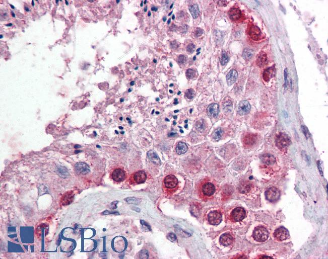 Anti-CUL4A / Cullin 4A antibody IHC of human testis. Immunohistochemistry of formalin-fixed, paraffin-embedded tissue after heat-induced antigen retrieval. Antibody LS-B360 dilution 1:500.