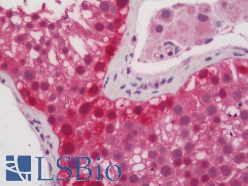 Human Testis: Formalin-Fixed, Paraffin-Embedded (FFPE)
