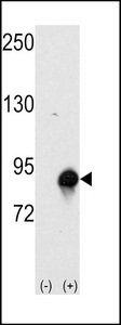 Western blot of CUL4a (arrow) using rabbit polyclonal CUL4a Antibody (Human N-term). 293 cell lysates (2 ug/lane) either nontransfected (Lane 1) or transiently transfected with the CUL4a gene (Lane 2) (Origene Technologies).