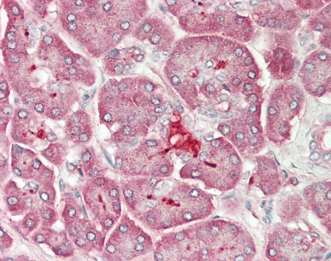 Human Pancreas: Formalin-Fixed, Paraffin-Embedded (FFPE)