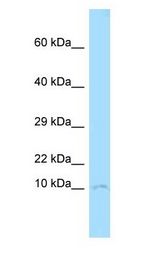 CKS1B / CKS1 antibody Western Blot of Mouse Thymus.