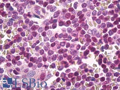 Anti-CKS1 antibody IHC of human spleen. Immunohistochemistry of formalin-fixed, paraffin-embedded tissue after heat-induced antigen retrieval. Antibody LS-B8108 dilution 5 ug/ml.