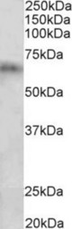 Cyp2d5 antibody (2 ug/ml) staining of Rat Spleen lysate (35 ug protein in RIPA buffer). Primary incubation was 1 hour. Detected by chemiluminescence.
