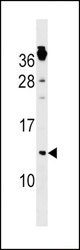 CKS1B Antibody western blot of NCI-H292 cell line lysates (35 ug/lane). The CKS1B antibody detected the CKS1B protein (arrow).
