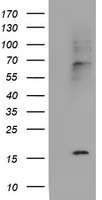 HEK293T cells were transfected with the pCMV6-ENTRY control (Left lane) or pCMV6-ENTRY CST2 (Right lane) cDNA for 48 hrs and lysed. Equivalent amounts of cell lysates (5 ug per lane) were separated by SDS-PAGE and immunoblotted with anti-CST2.