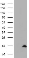 HEK293T cells were transfected with the pCMV6-ENTRY control (Left lane) or pCMV6-ENTRY CST2 (Right lane) cDNA for 48 hrs and lysed. Equivalent amounts of cell lysates (5 ug per lane) were separated by SDS-PAGE and immunoblotted with anti-CST2.