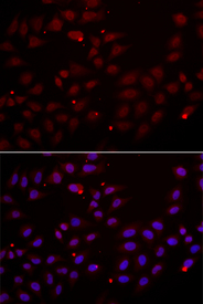 Immunofluorescence analysis of HeLa cell using CST2 antibody. Blue: DAPI for nuclear staining.