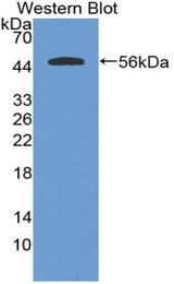 Western blot of recombinant Cystatin SA / CST2.