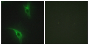 Immunofluorescence of HeLa cells, using CKS1 Antibody. The picture on the right is treated with the synthesized peptide.