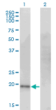 Western Blot analysis of CDO1 expression in transfected 293T cell line by CDO1 monoclonal antibody (M09), clone 4B4.Lane 1: CDO1 transfected lysate(23 KDa).Lane 2: Non-transfected lysate.
