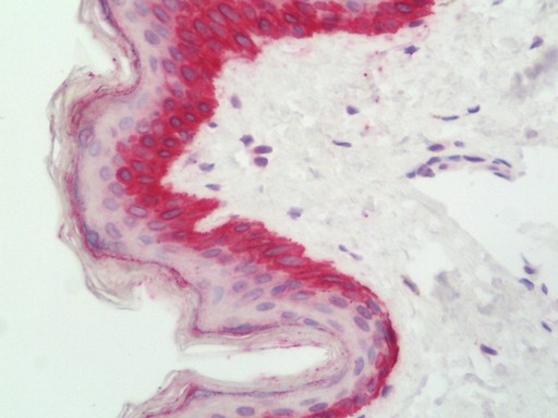 Human Skin: Formalin-Fixed, Paraffin-Embedded (FFPE)