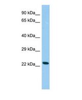 Western blot of Cdo1 Antibody - C-terminal region in Rat Testis cells lysate.