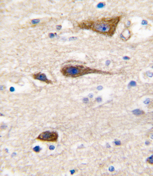 Formalin-fixed and paraffin-embedded human brain tissue reacted with CYP2R1 antibody , which was peroxidase-conjugated to the secondary antibody, followed by DAB staining. This data demonstrates the use of this antibody for immunohistochemistry; clinical relevance has not been evaluated.