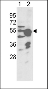 Western blot of CYP2R1 Antibody in NCI-H460 cell line(lane 1) and mouse liver tissue(lane 2) lysates (35 ug/lane). CYP2R1 (arrow) was detected using the purified antibody.