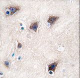 Formalin-fixed and paraffin-embedded human brain tissue reacted with CYP2R1 antibody , which was peroxidase-conjugated to the secondary antibody, followed by DAB staining. This data demonstrates the use of this antibody for immunohistochemistry; clinical relevance has not been evaluated.