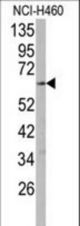 Western blot of anti-CYP2R1 Antibody in NCI-H460 cell line lysates (35 ug/lane). CYP2R1(arrow) was detected using the purified antibody.