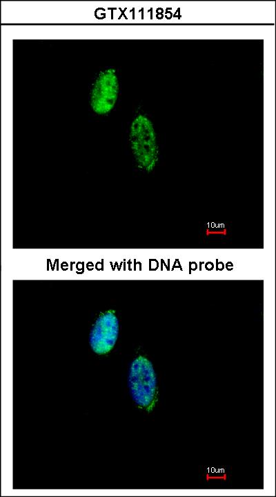 Immunofluorescence of paraformaldehyde-fixed HeLa using CKS-2 antibody at 1:500 dilution.