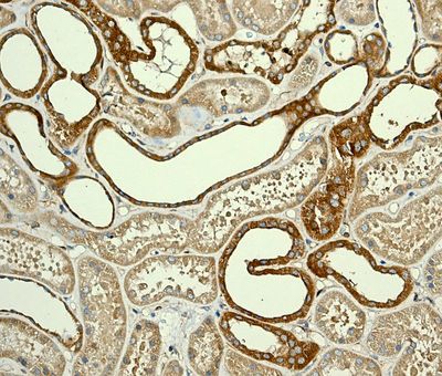 IHC of paraffin-embedded human kidney tissue using anti-CLASP1 antibody.