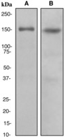 Western blot analysis on (A) T47-D and (B) C6 cell lysates using anti-CLASP1 antibody.