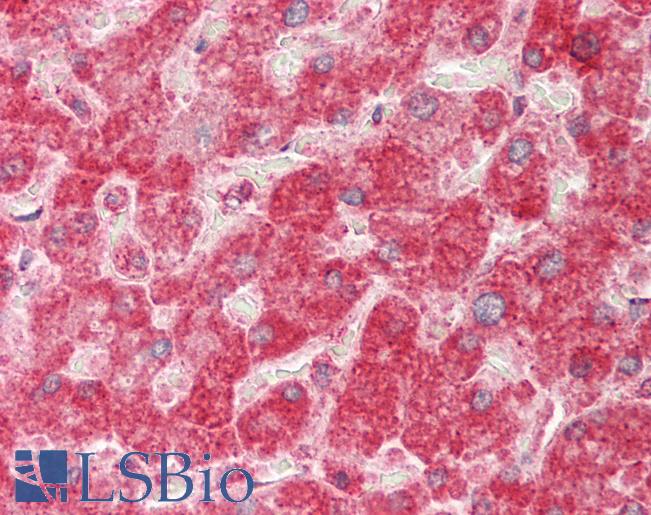 Human Liver: Formalin-Fixed, Paraffin-Embedded (FFPE)