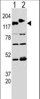 Western blot of CLASP (arrow) using rabbit polyclonal CLASP Antibody (Y1019). 293 cell lysates transfected with the ACADL gene (Lane 1) and with the GFP-CLASP (Lane 2).