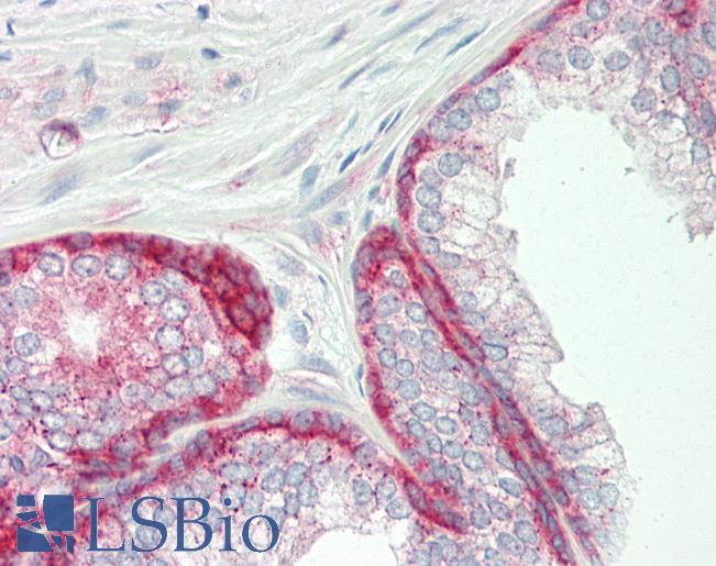 Human Prostate: Formalin-Fixed, Paraffin-Embedded (FFPE)