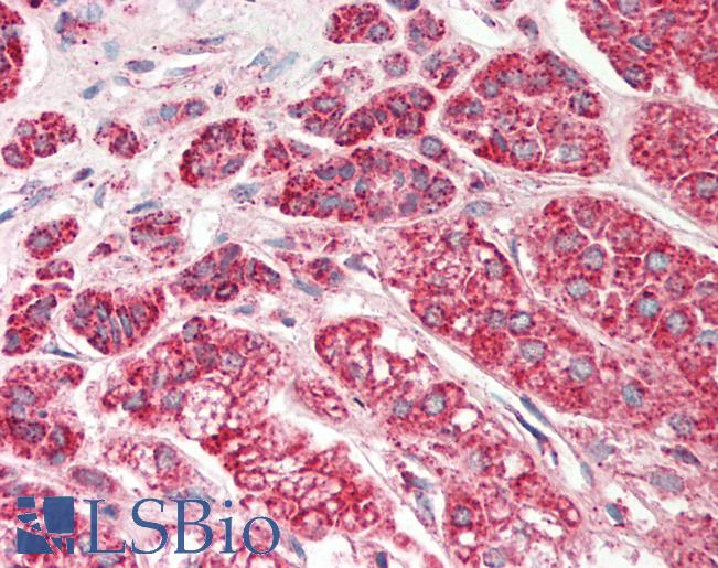 Human Adrenal: Formalin-Fixed, Paraffin-Embedded (FFPE)