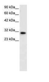 HepG2 Cell Lysate
